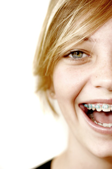 photo of girl with braces